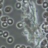 Test HLBO